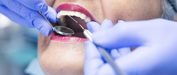 Best Urgent Care for Lost Fillings or Crowns in Palo Cedro, CA